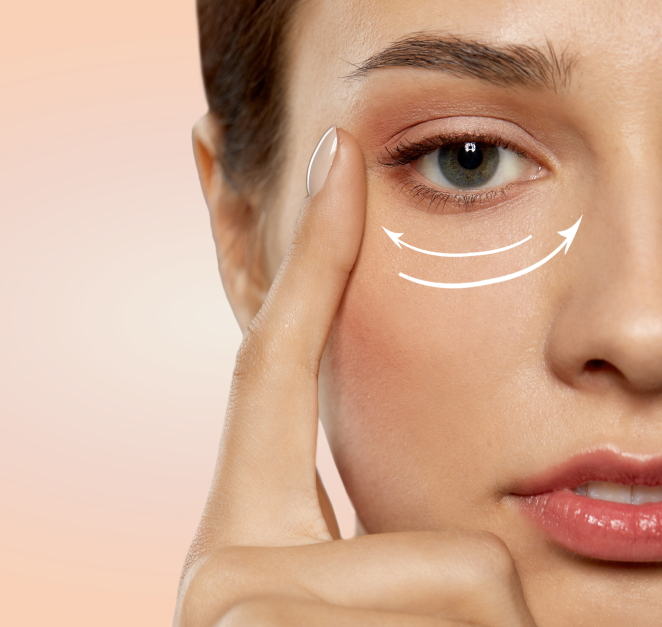 Eyebag Surgery